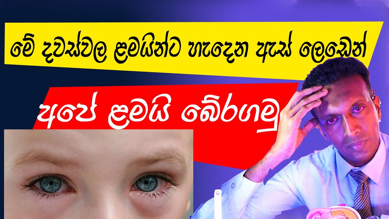 මේ දවස්වල ලමයින්ට හැදෙන ඇස් ලෙඩෙන් බේරෙමු . How to avoid #conjunctivitis #redeye #sinhalaeye