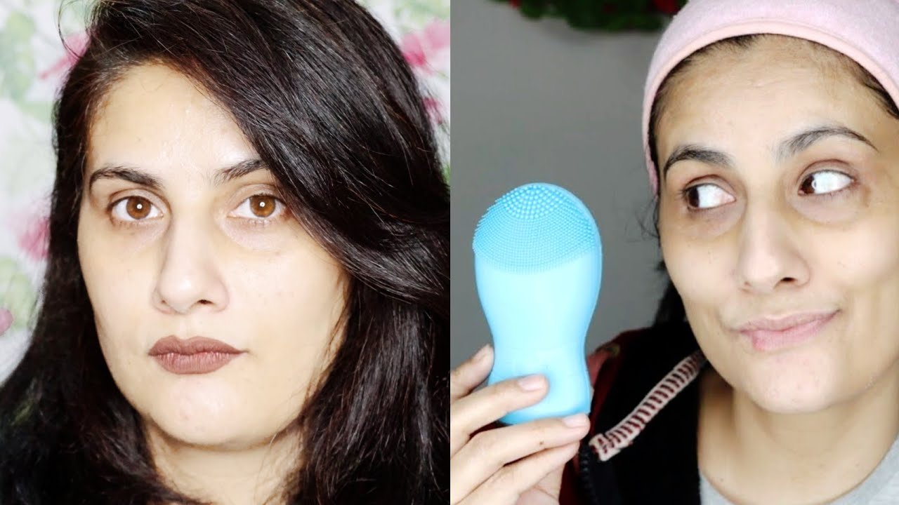 How I cured my dark circles I ये जरूर आपके dark circles पर काम करेगा । Not a clickbait