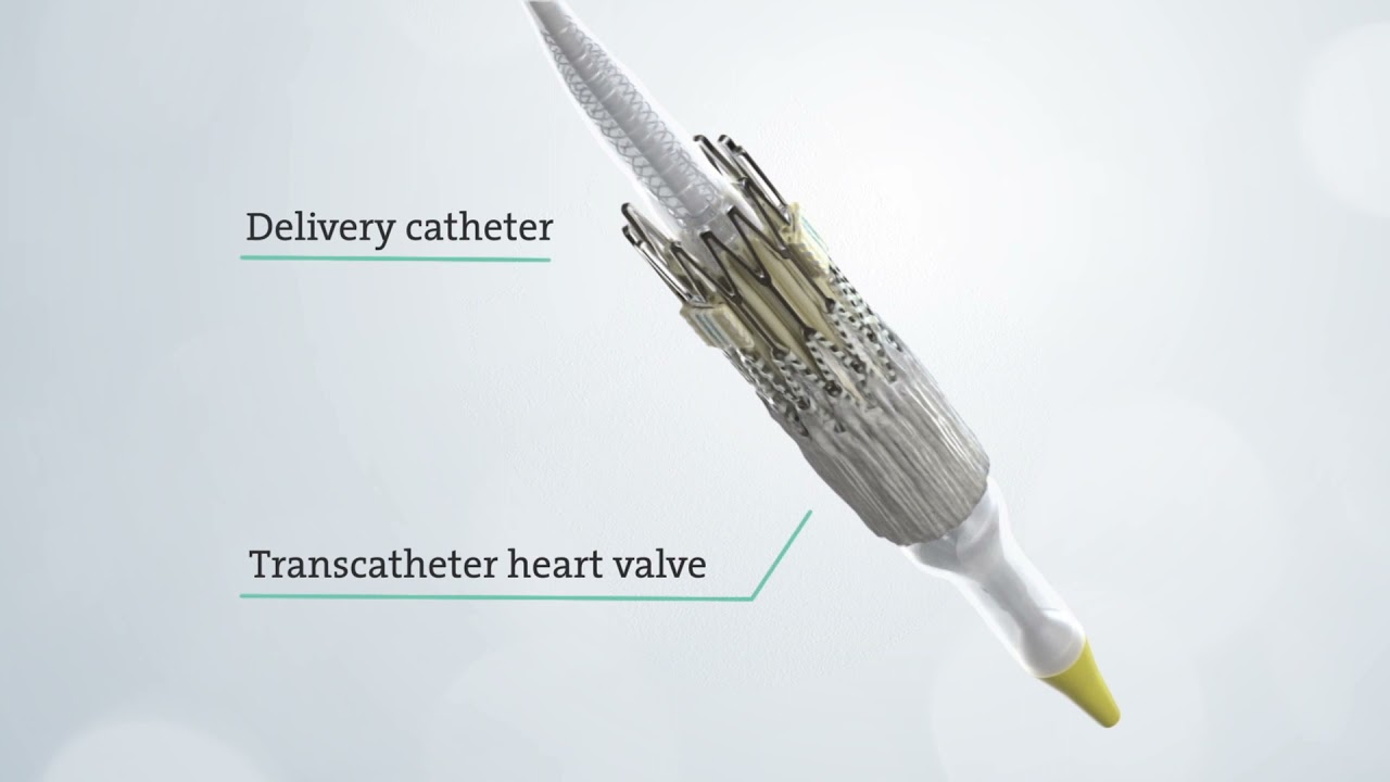 TAVR - Transcatheter aortic valve replacement procedure overview