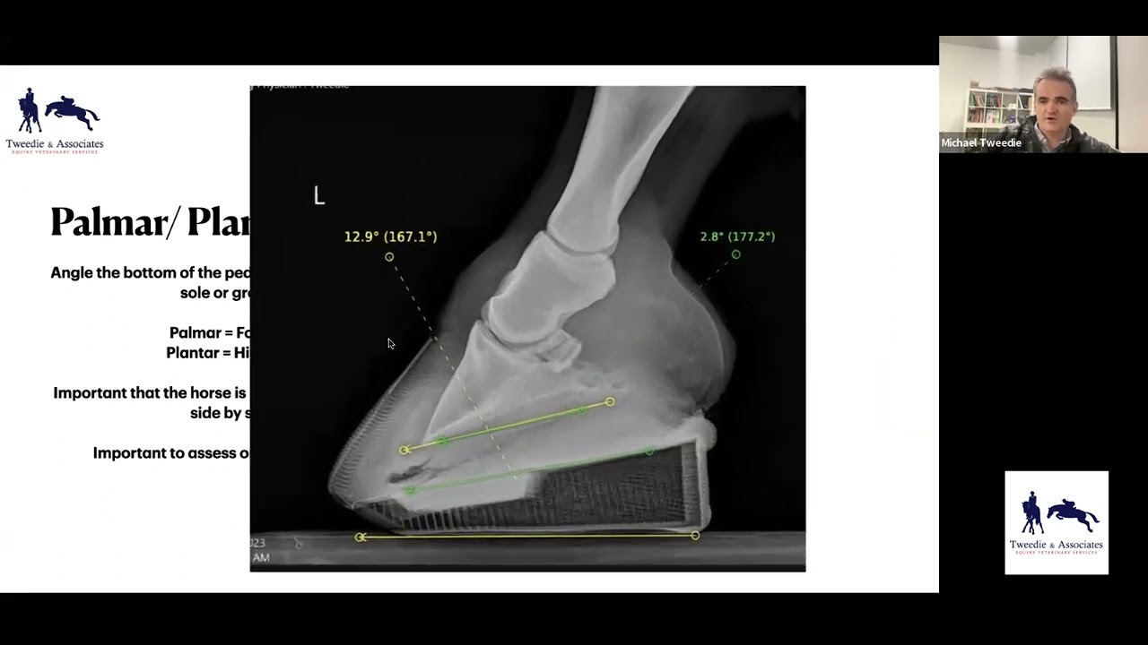 Foot Balance Xrays for Performance