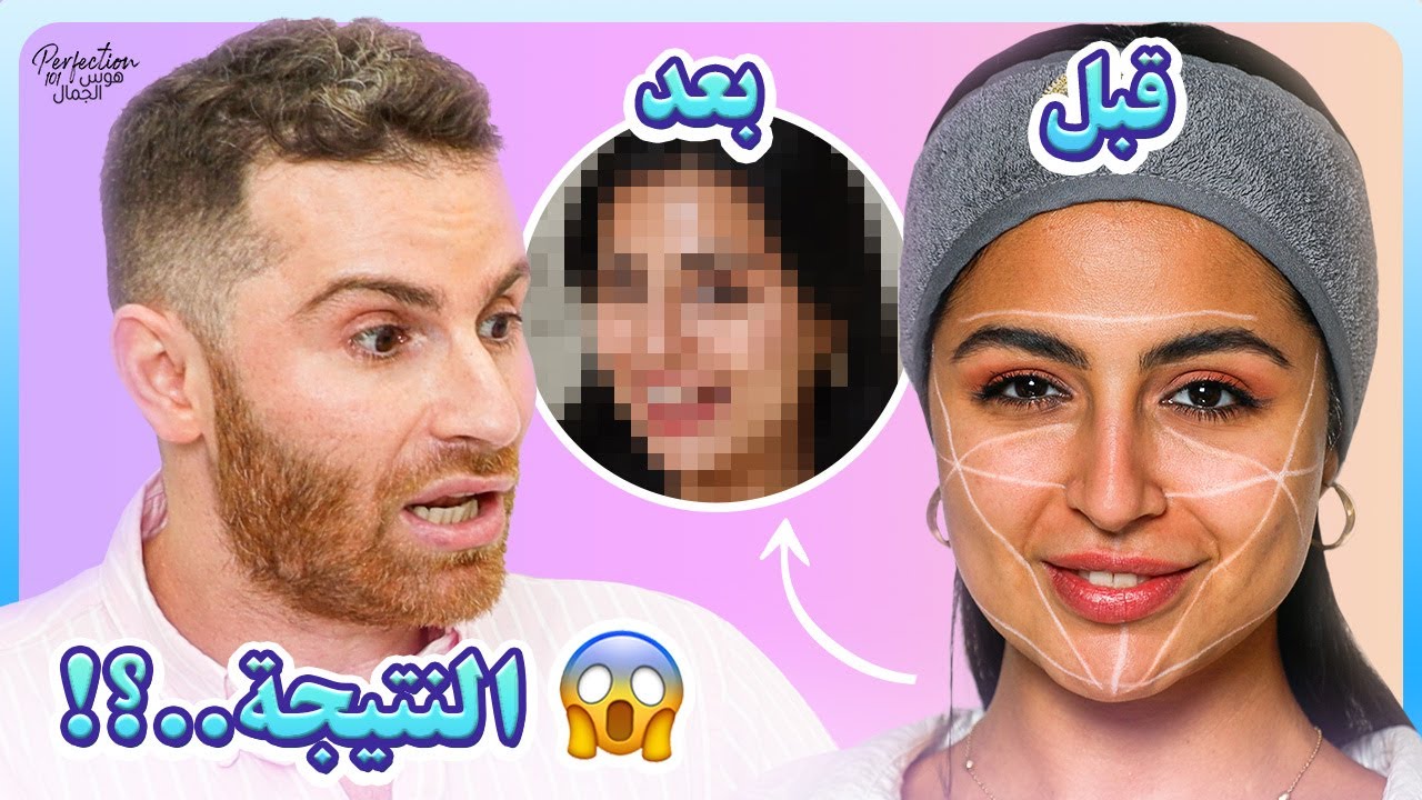 ليلى عقيل بعد عمليات التجميل... النتيجة صادمة! 😮