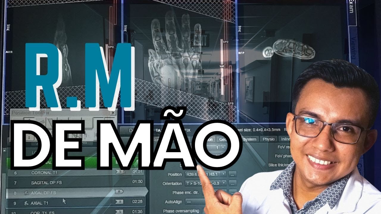 APRENDA HOJE COMO PROGRAMA R M DE MÃO #RADIOLOGIA
