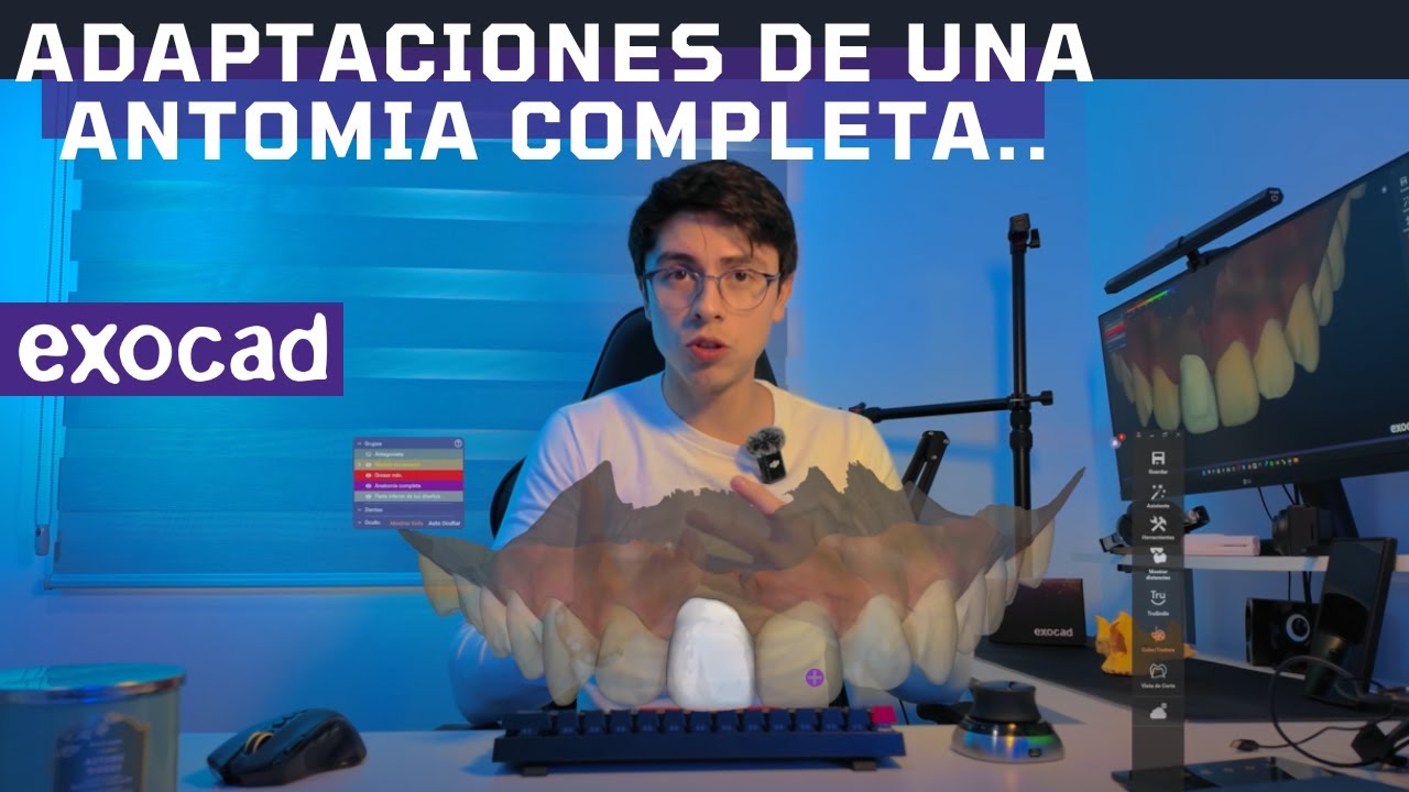 💥Diferentes entornos al momento de adaptar una anatomía completa en exocad💥