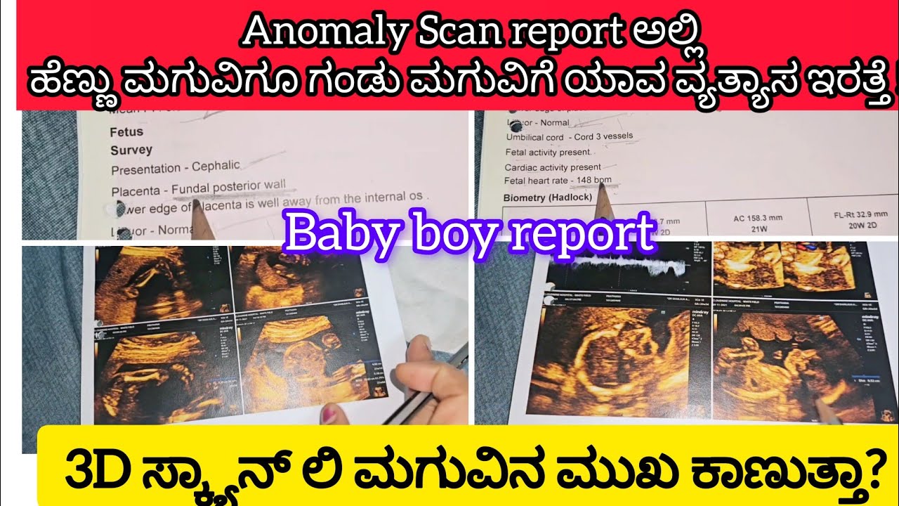 #Babyboy Anomaly Scan/3Dpic ನಲ್ಲಿ genderಗೊತ್ತಾಗುತ್ತಾ😱ಮಗು ಬ್ರೈನ್,ಹಾರ್ಟ್ Develop Defect💯%ಗೊತ್ತಾಗುತ್ತಾ?