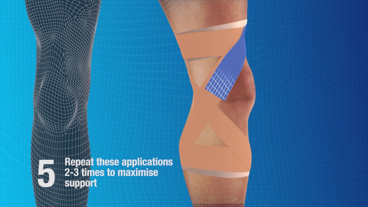 Elastoplast: How to strap and support the knee summary