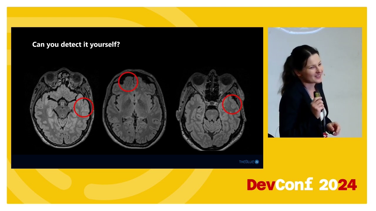 Agata Chudzińska - Leveraging Continual Learning for Advanced MRI Analysis