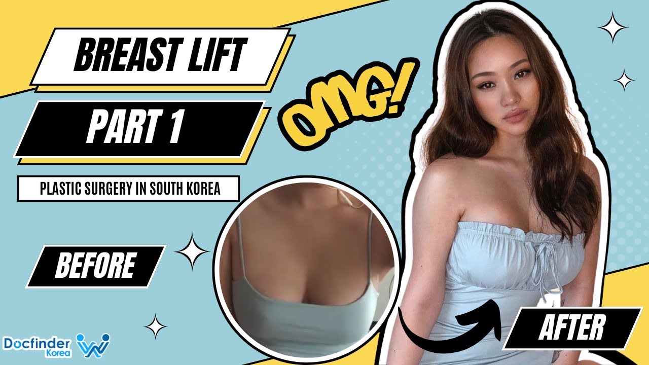 Best BOOB JOB experience in Korea! Part 1