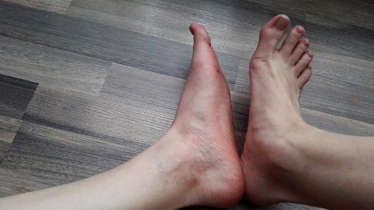 my size 8 male feet (size 41 Eu) - next video