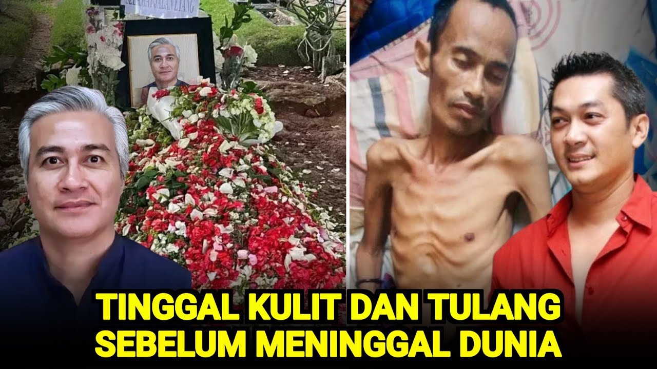 Pantas Tak Tampil Di TV Lagi, 7 Artis Ini Alami Sakit Parah TINGGAL TULANG Hingga Meninggal Dunia