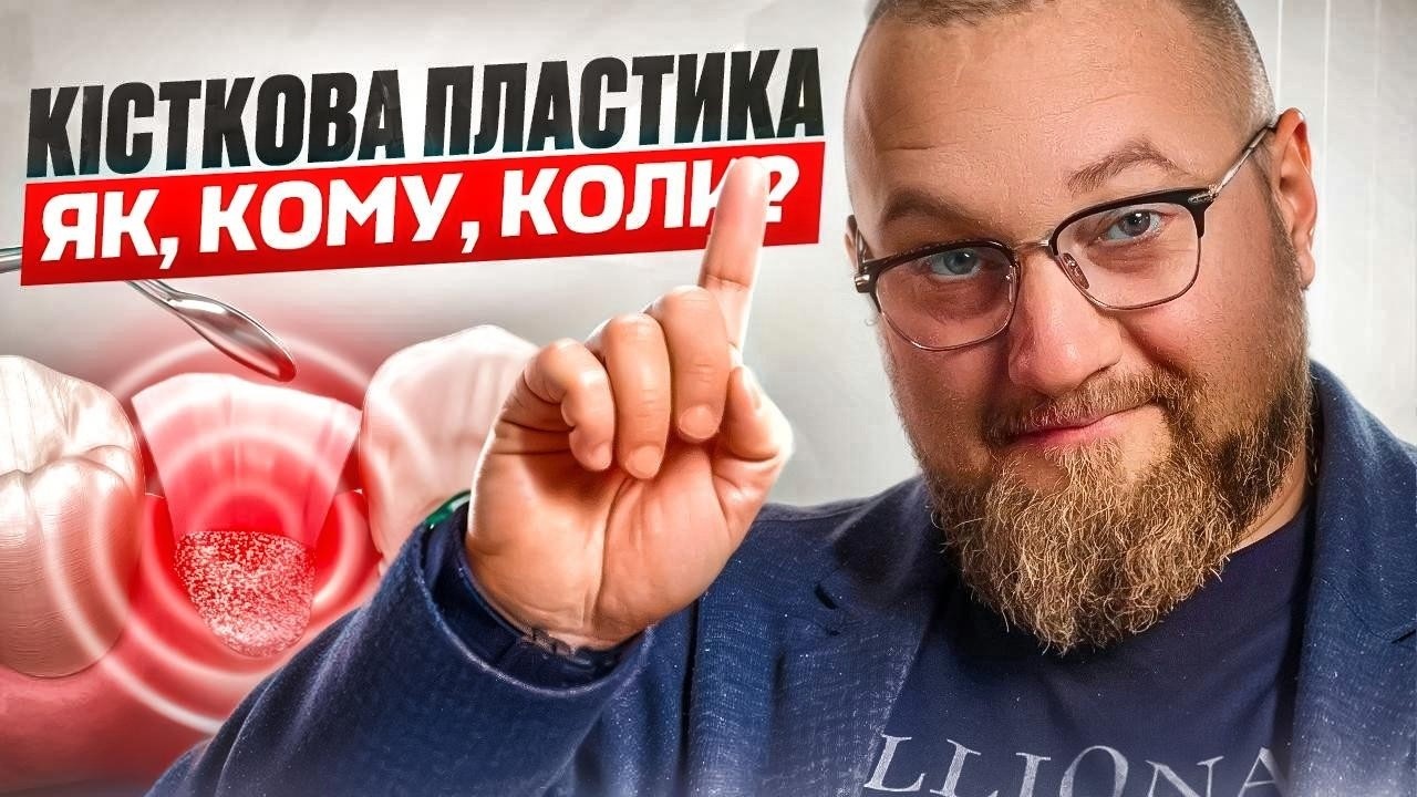 🇺🇦 Что такое наращивание кости во время имплантации зубов?