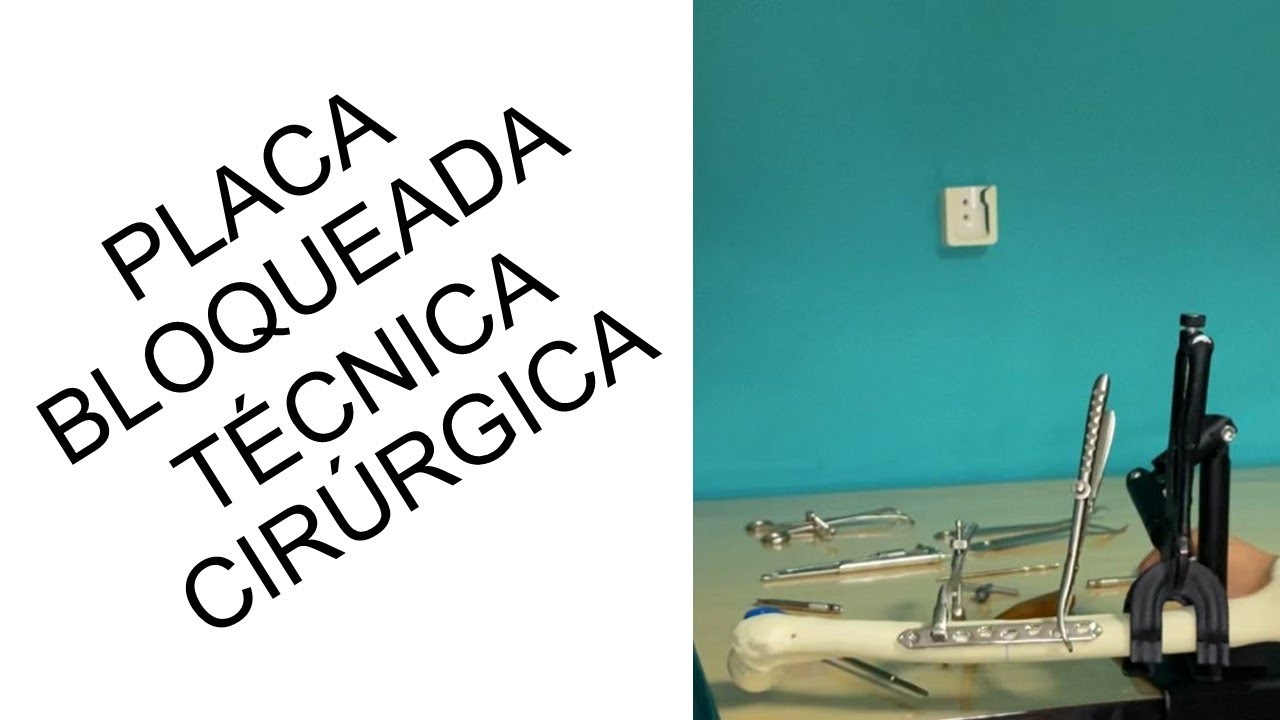 Técnica cirúrgica de placa bloqueada