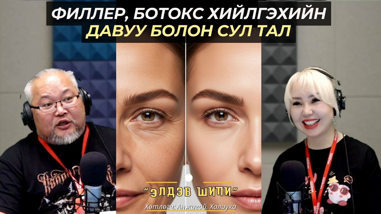 Элдэв шипи | 2026-02-23 | Филлер, ботокс хийлгэхийн давуу болон сул тал