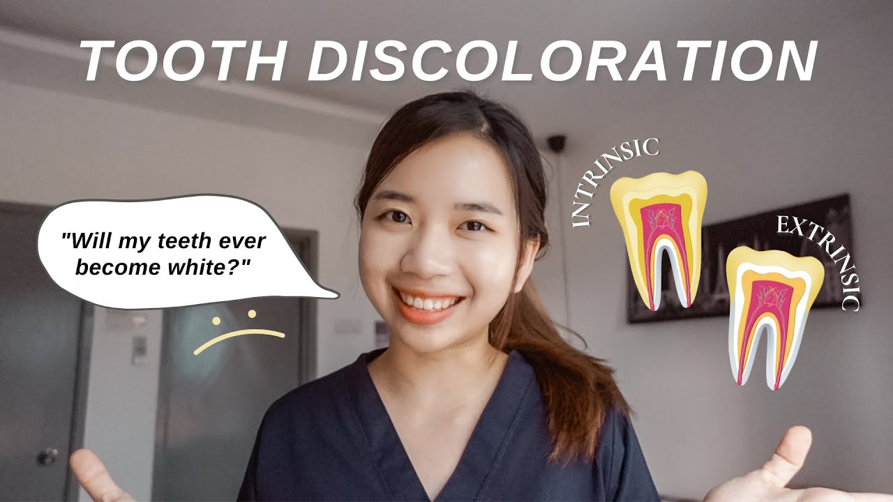 Why are my teeth yellow? I brush everyday! // Dentist Answers