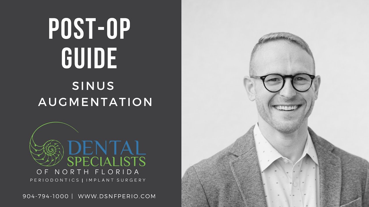 Post-Operative Guide: Sinus Augmentation | Dr. John W. Thousand IV