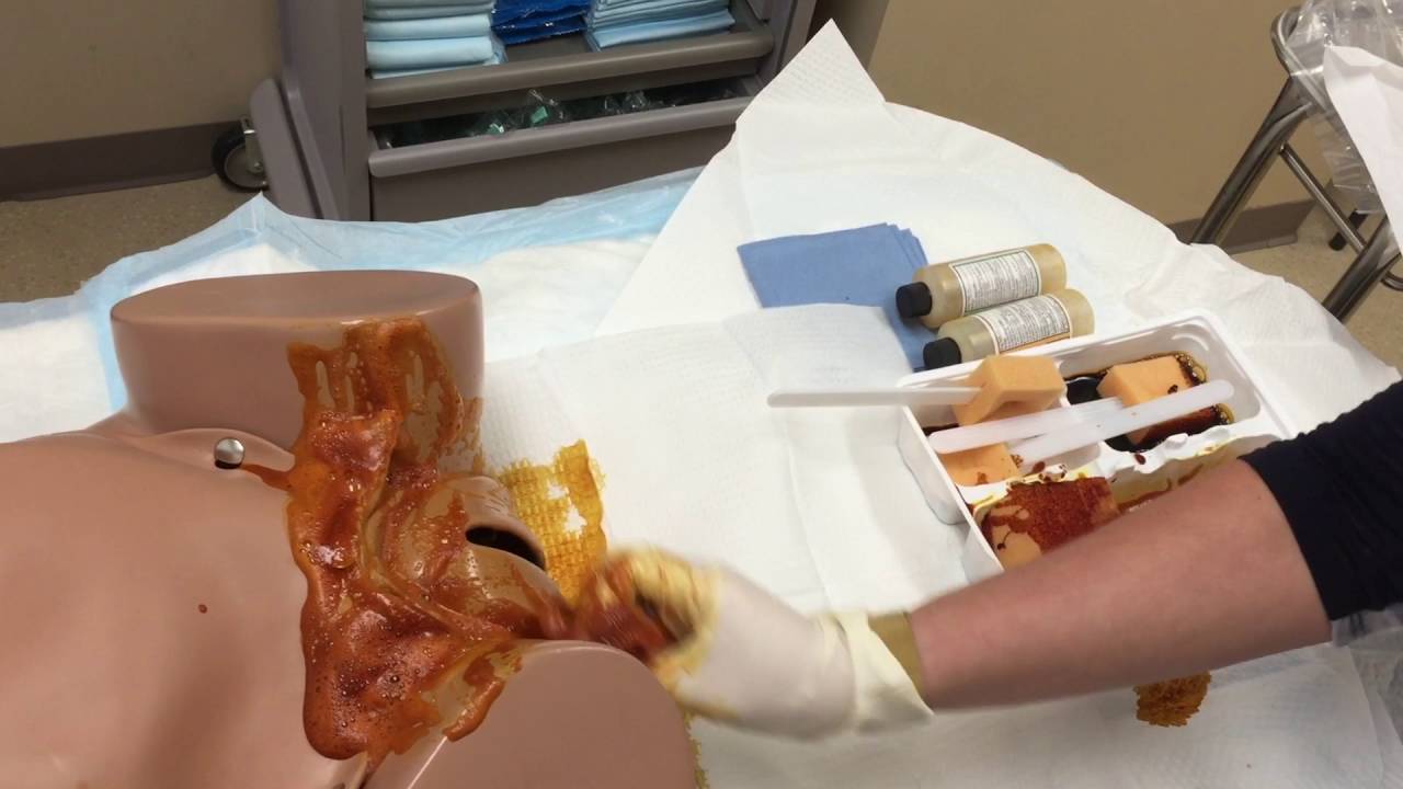 Vaginal Prep (Updated)