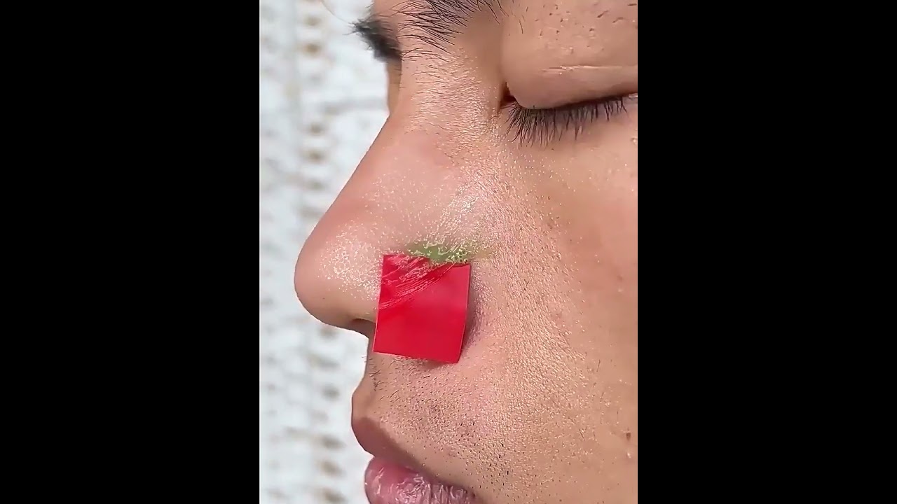 去黑頭粉刺積雪草泡泡面膜