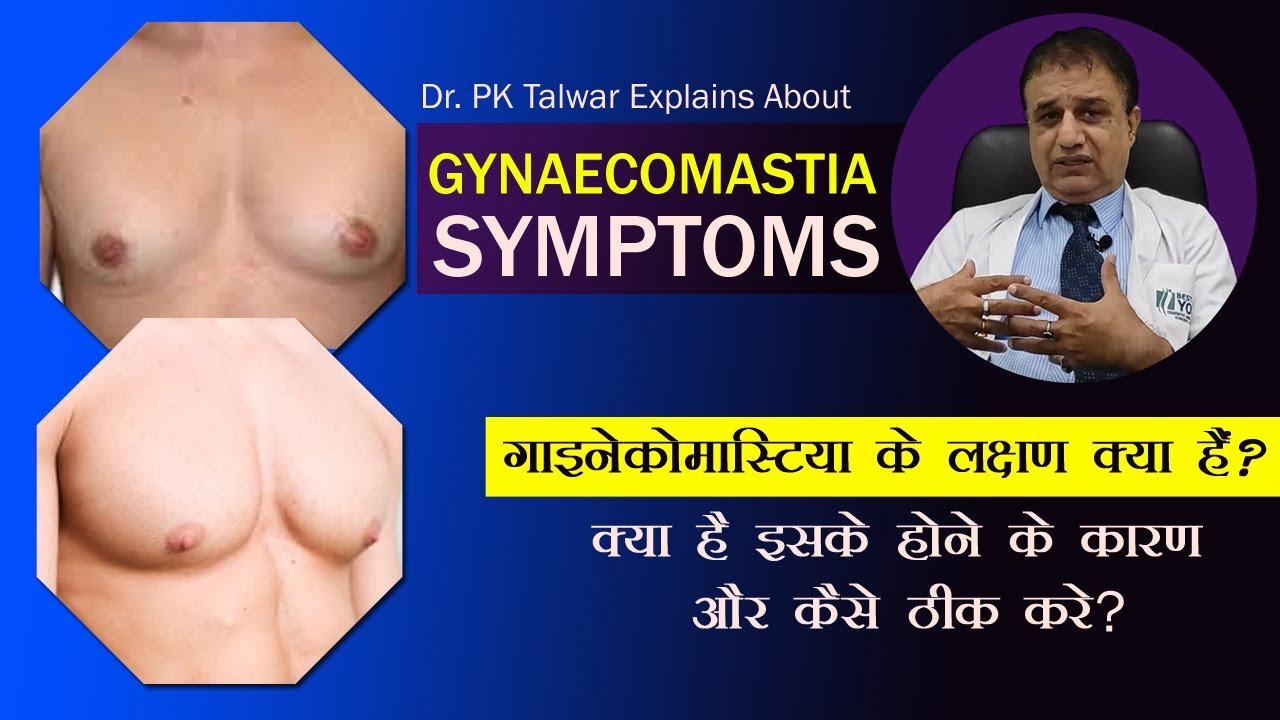 Symptoms of Gynecomastia, Gynaecomastia के लक्षण क्या हैं और कैसे ठीक करे ?  Dr. PK Talwar