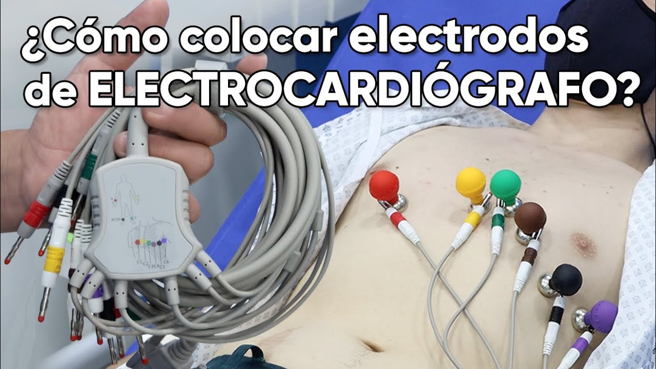 ¿Cómo colocar los electrodos de un electrocardiógrafo?