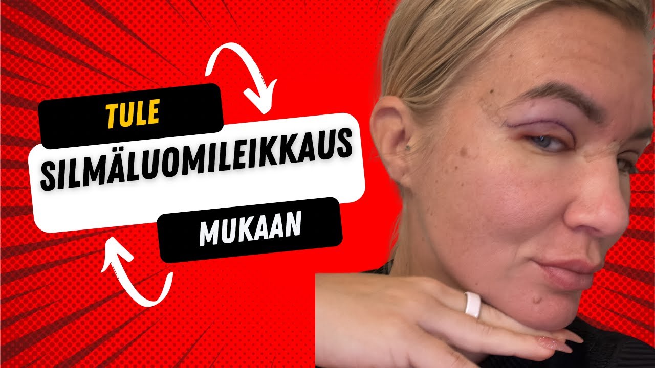 Mun silmäluomet leikataan
