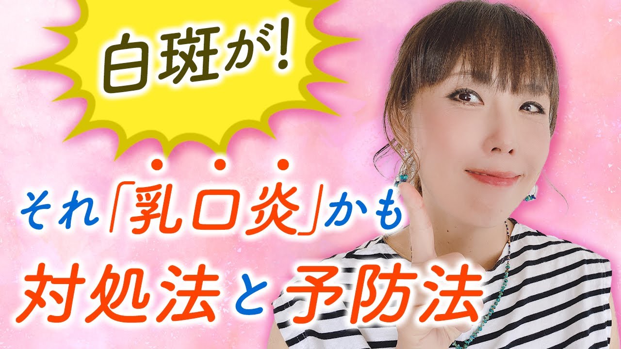 白斑が！それ『乳口炎』かも 対処法と予防法