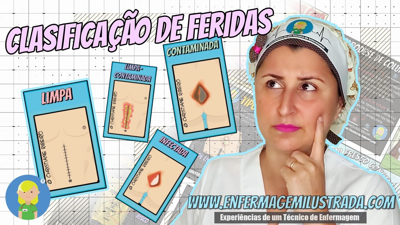 Classificação de Feridas: da LIMPA para a mais CONTAMINADA!