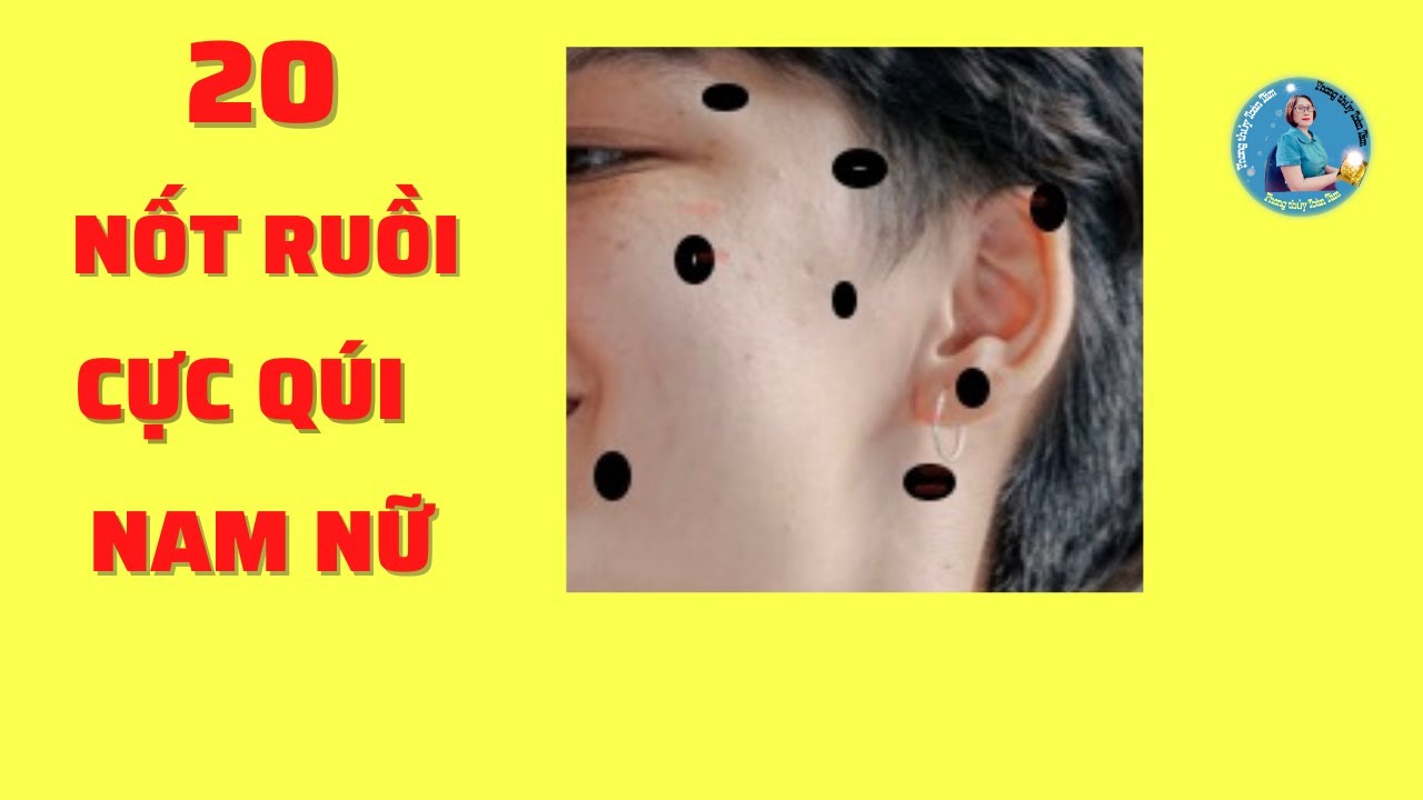 ✅ 20 Nốt Ruồi Qúi Hiếm Trên Mặt Đàn Ông Phụ Nữ Lộc Trời Không Nên Xóa | Phong Thủy Toàn Tâm