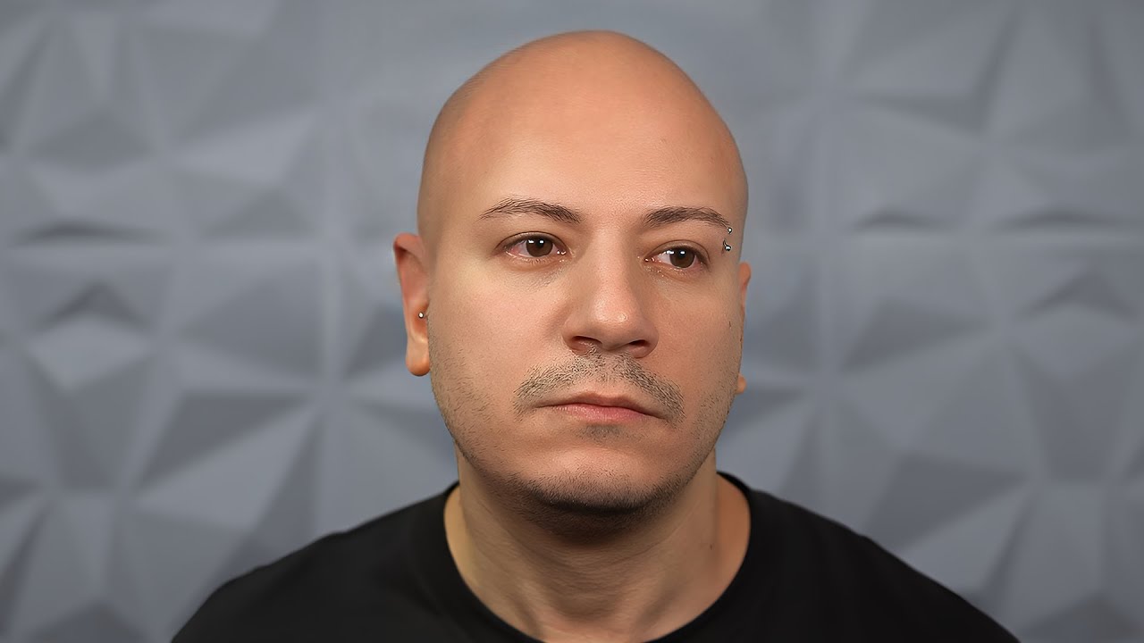 VI RACCONTO DI QUANDO HO PERSO I CAPELLI