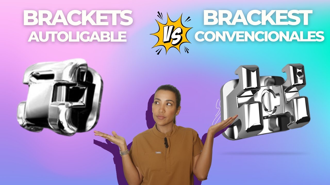 DIFERENCIAS ENTRE BRACKETS CONVENCIONALES Y BRACKETS AUTOLIGADOS #brackets #dentista #orthodontist
