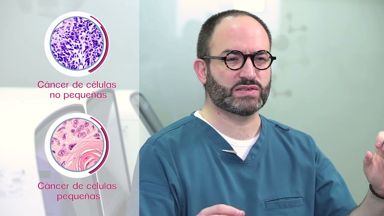 Nuevas fronteras en la biomarcación para inmunoterapia en tumores sólidos.