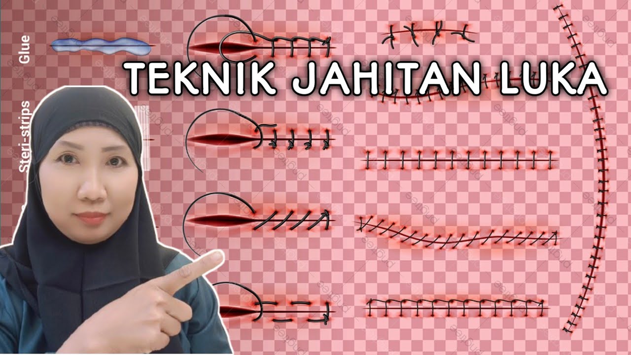 JENIS TEKNIK JAHITAN YANG HARUS DI KETAHUI