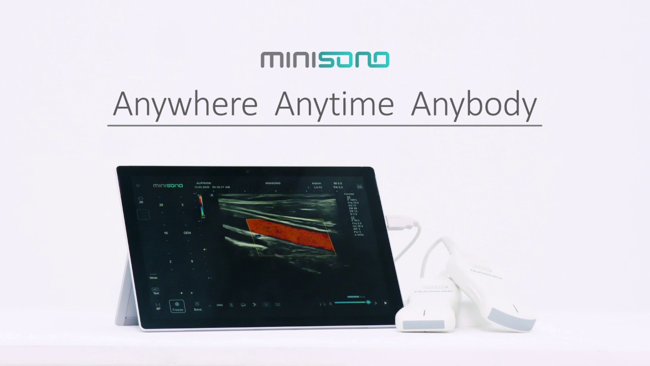 Introducing the Alpinion Minisono