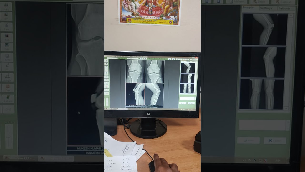 x-ray ki print kaise de difference between blur aur real image #xray #xrayfilmprint
