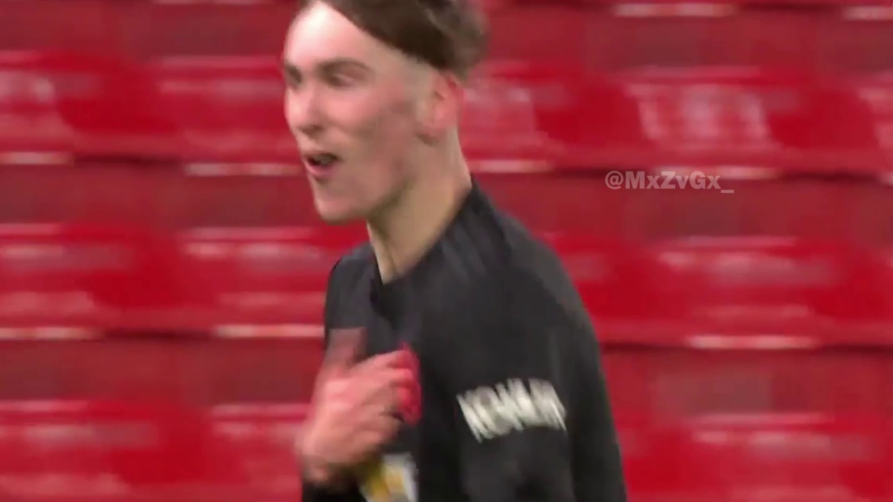 James Garner v Stoke U23 [02-03-2020]