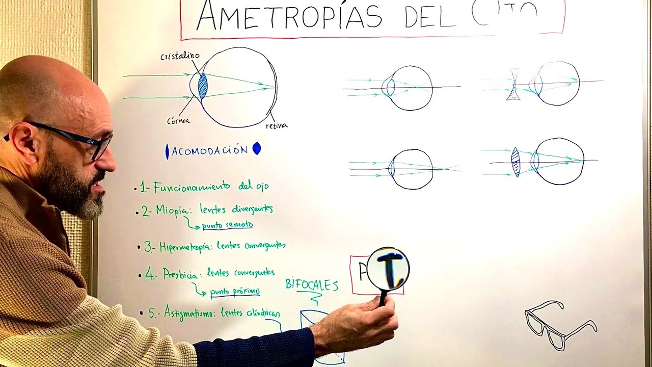 Física 9.07 ¿Cómo funcionan las gafas? Ametropías del ojo: miopía, hipermetropía, presbicia, astigm.