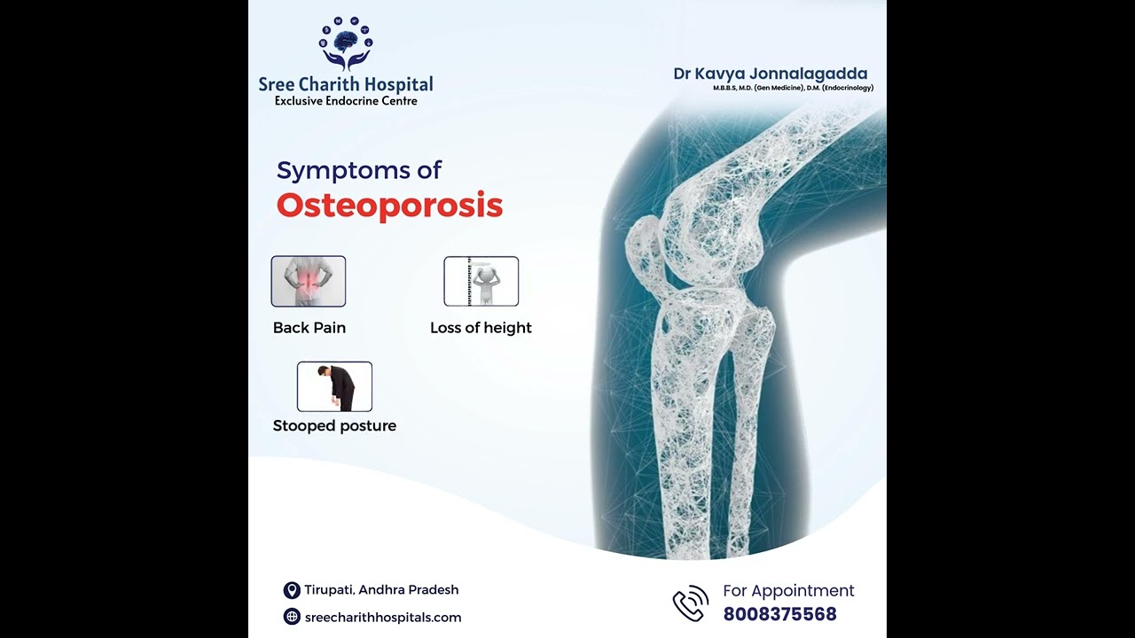 Osteoporosis symptoms include back pain, loss of height, stooped posture, and bone fractures. Early