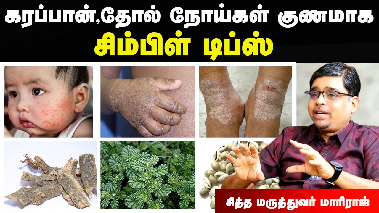 கரப்பான் நோய் குணமாக | Karappan skin disease in tamil | eczema treatment in tamil | Doctor Interview