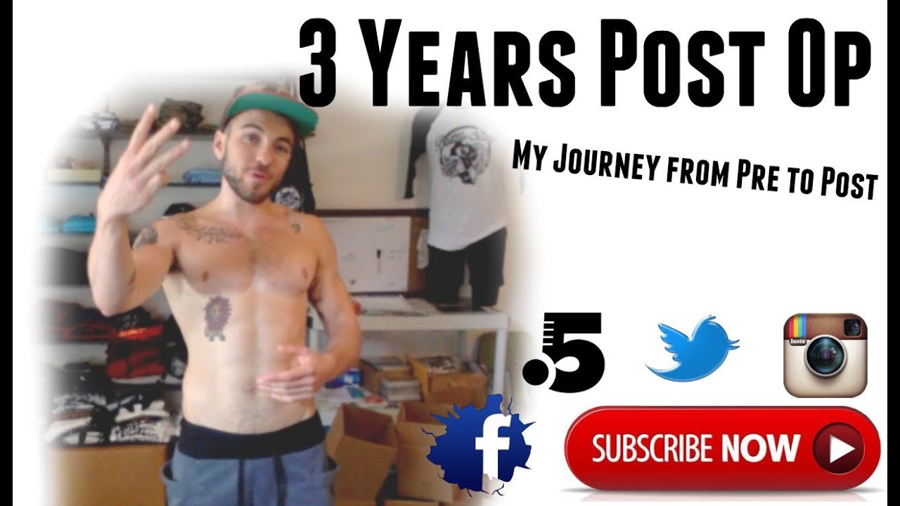 Top Surgery 3 years Post Op2