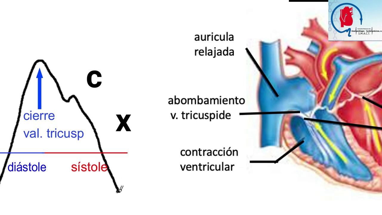 PVC NORMAL