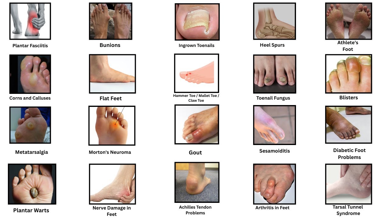 Common Foot Issues and What Causes Them