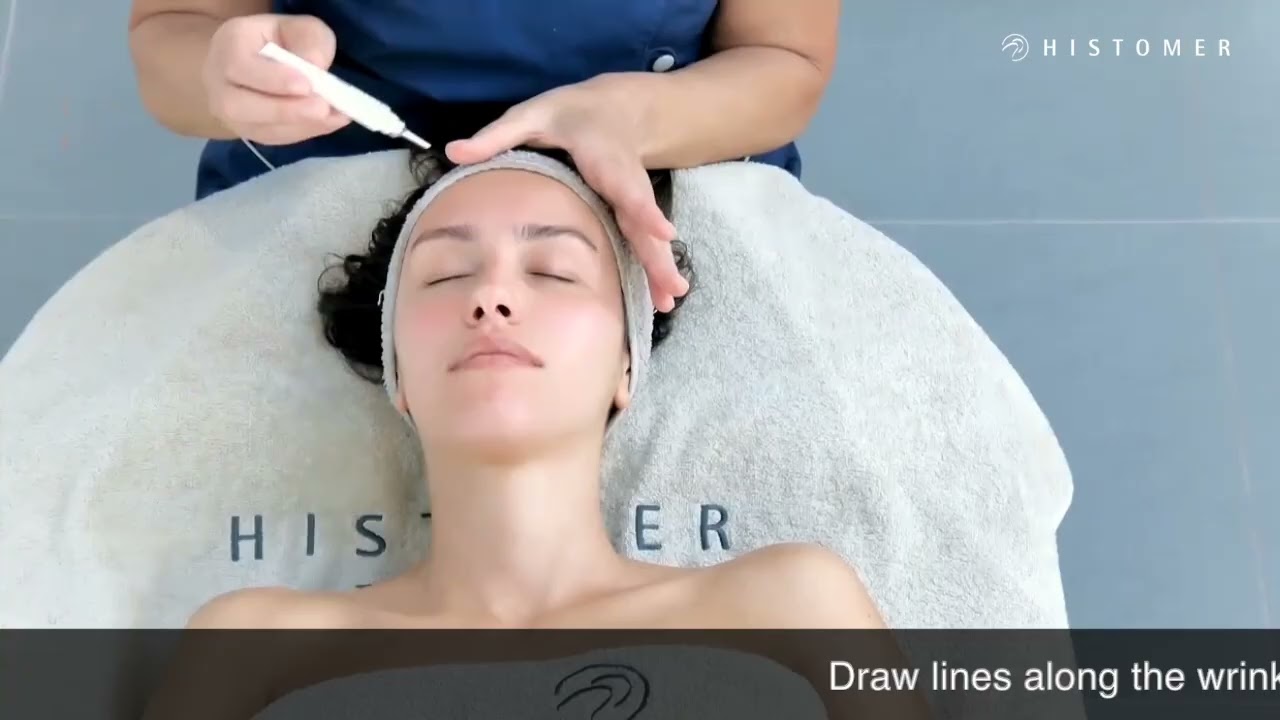 Histomer ContinVe Professional Treatment