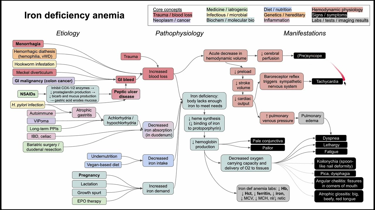 Iron deficiency anemia (mechanism of disease)