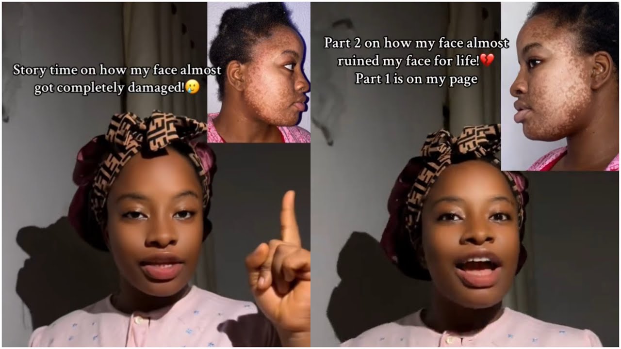 How my face almost got damaged || Why you should  stop letting people recommend skincare for you!