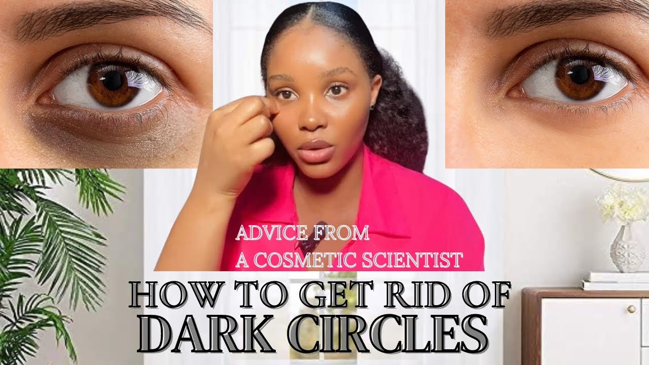 PROVEN TIPS TO GET RID OF DARK CIRCLES