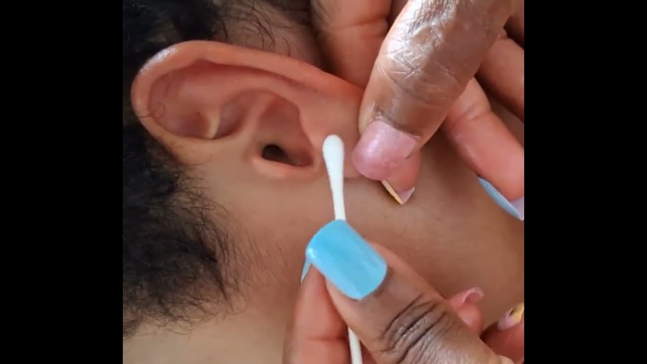 ASMR 😴 Satisfying Deep Ear Cleaning with gum cracking 