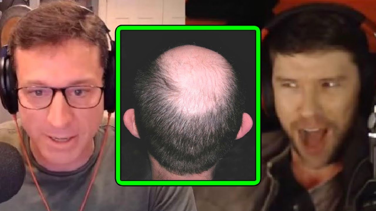 Will Taking TRT Make You Go BALD!? | PKA
