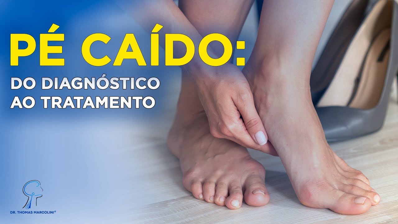 Trate Agora o Pé Caído: Causas, Diagnóstico e Como Recuperar Seus Movimentos!