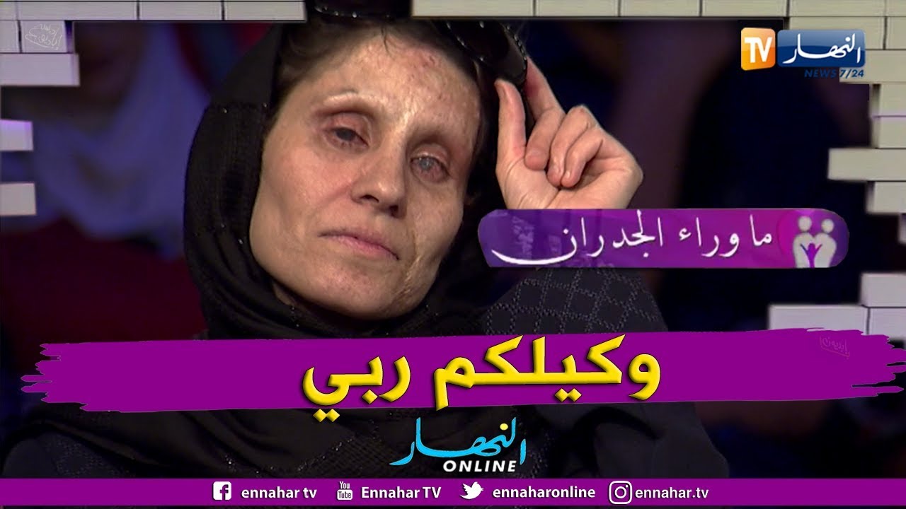 ما وراء الجدران: إعتداء وحشي بحمض 