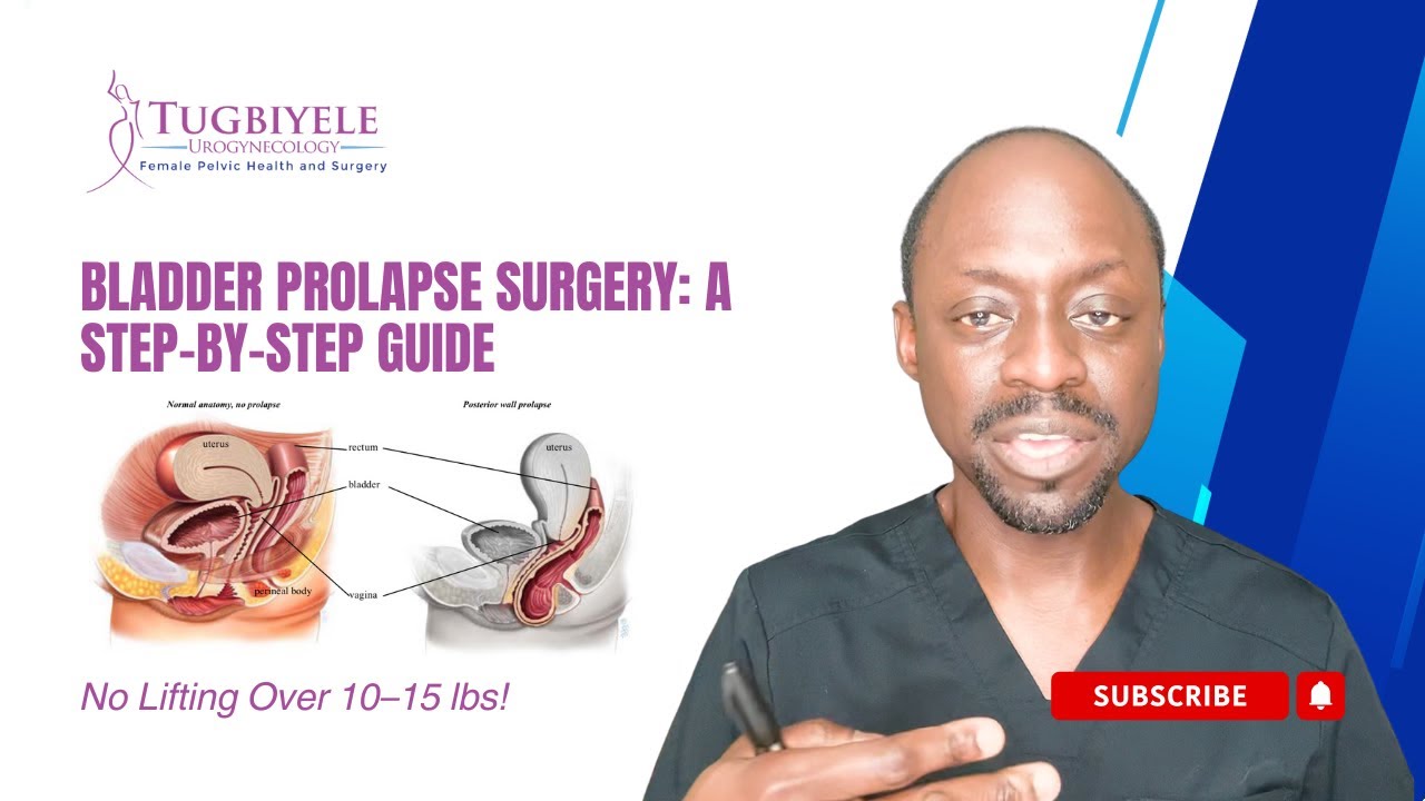 Bladder Prolapse Surgery: A Step-by-Step Guide