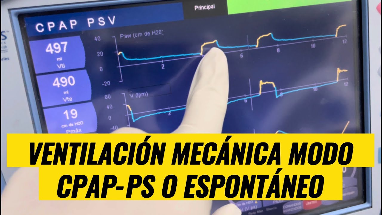 Ventilacion mecanica modo CPAP-PS o Espontaneo