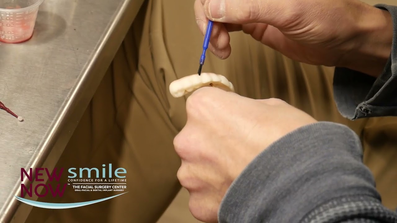Ever wonder how All-on-4® teeth are made? 👀 Watch the magic happen from start to finish!